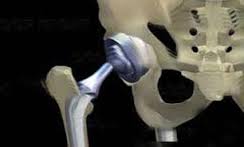 ارتوپد (orthoped) ، دکتر ارتوپد چکار میکند؟