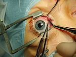 متخصص چشم پزشکی 1