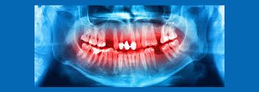 متخصص بیماری های دهان : (Oral Dentist) کیست؟