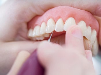 دندانپزشکی ترمیمی 4