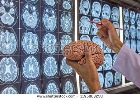جراح مغز و اعصاب 2
