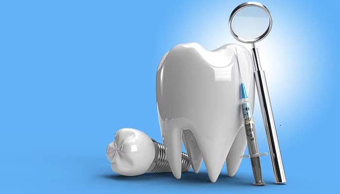 مزایایی ایمپلنت دندان