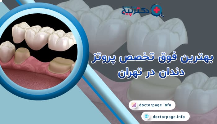 بهترین فوق تخصص پروتز دندان در تهران